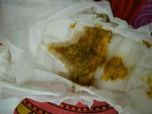 梦见小孩拉屎拉床上
